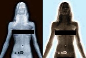 Xray Nudes